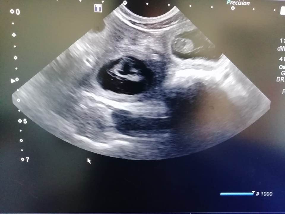 Du bois de balisy - Gestation confirmée pour Noumai
